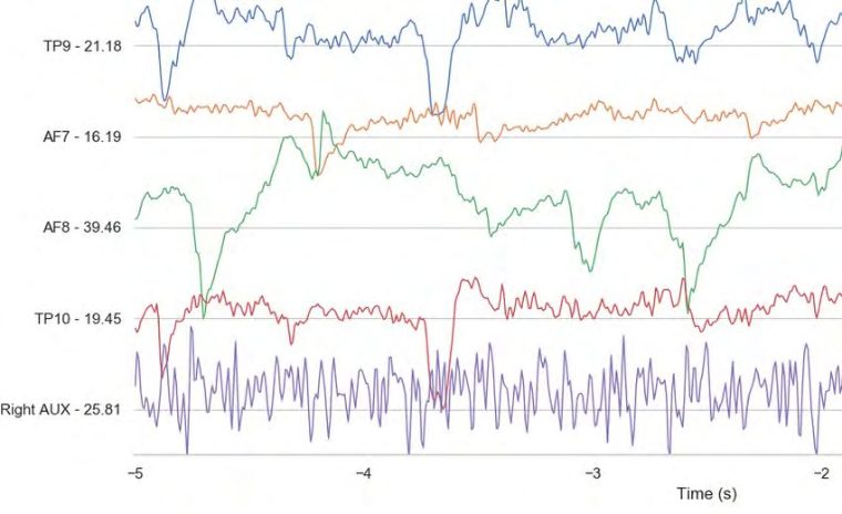 Signal charts
